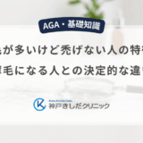 抜け毛が多いけど禿げない人の特徴は？薄毛になる人との決定的な違い