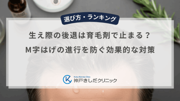 生え際の後退は育毛剤で止まる？M字はげの進行を防ぐ効果的な対策