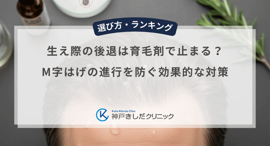 生え際の後退は育毛剤で止まる？M字はげの進行を防ぐ効果的な対策