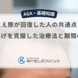 生え際が回復した人の共通点！M字はげを克服した治療法と期間の目安