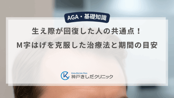 生え際が回復した人の共通点！M字はげを克服した治療法と期間の目安