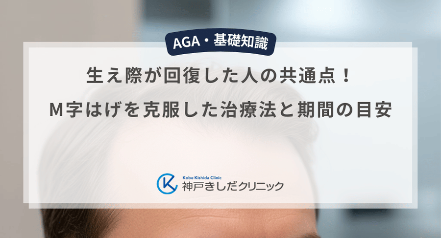 生え際が回復した人の共通点!M字はげを克服した治療法と期間の目安