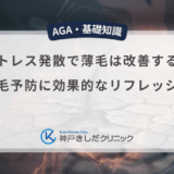 ストレス発散で薄毛は改善する？抜け毛予防に効果的なリフレッシュ術