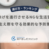 M字はげを進行させるNGな生活習慣！生え際を守る効果的な予防策