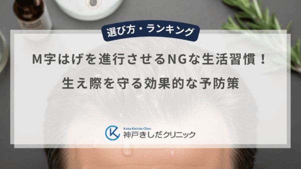 M字はげを進行させるNGな生活習慣！生え際を守る効果的な予防策