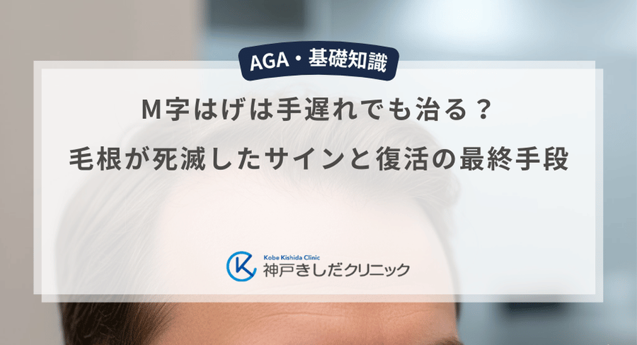 M字はげは手遅れでも治る？毛根が死滅したサインと復活の最終手段