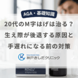 20代のM字はげは治る？生え際が後退する原因と手遅れになる前の対策