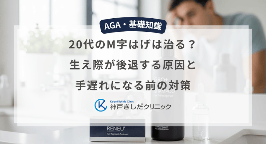 20代のM字はげは治る？生え際が後退する原因と手遅れになる前の対策