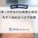 見逃し厳禁！M字はげの危険な前兆サインと今すぐ始めるべき予防策