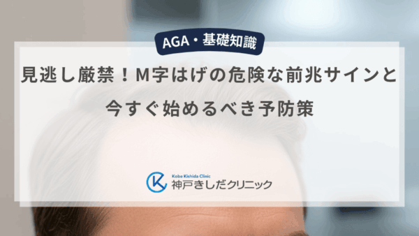 見逃し厳禁！M字はげの危険な前兆サインと今すぐ始めるべき予防策