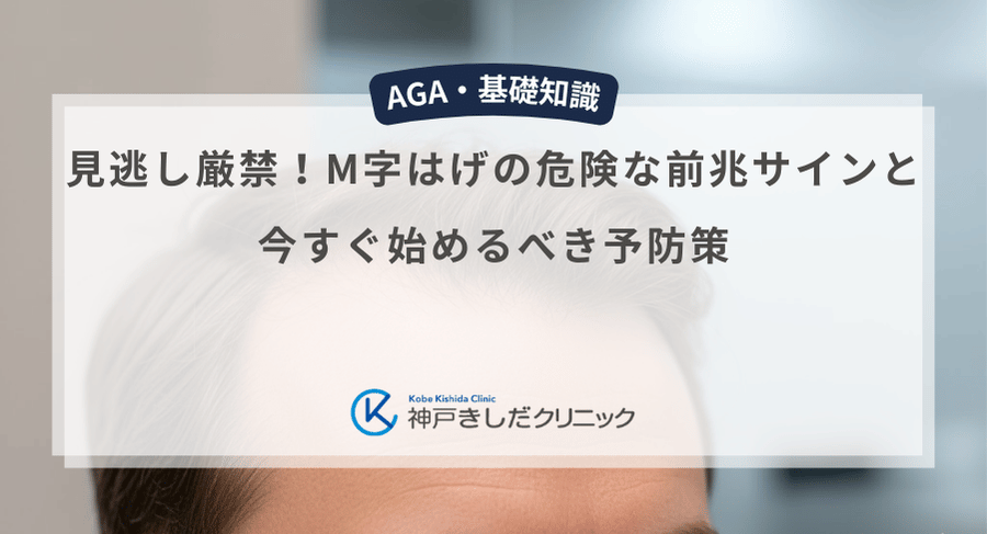 見逃し厳禁!M字はげの危険な前兆サインと今すぐ始めるべき予防策