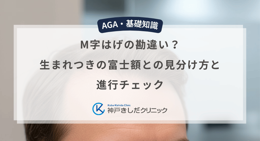 M字はげの勘違い?生まれつきの富士額との見分け方と進行チェック