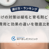M字はげの対策は植毛と育毛剤どっち？費用と効果の違いを徹底比較