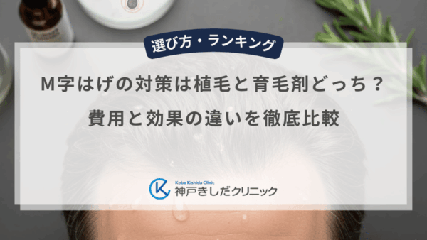 M字はげの対策は植毛と育毛剤どっち？費用と効果の違いを徹底比較