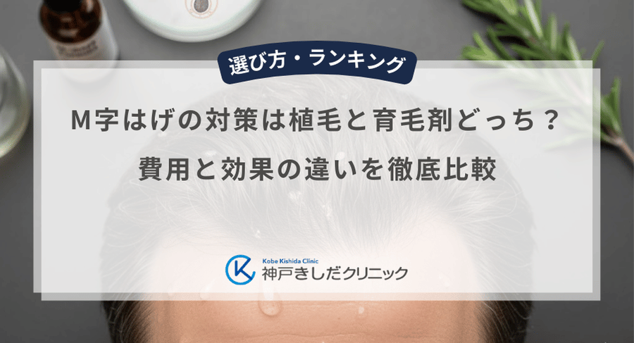 M字はげの対策は植毛と育毛剤どっち？費用と効果の違いを徹底比較