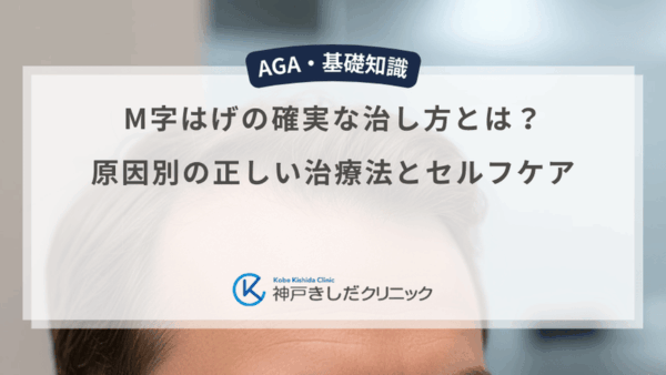 M字はげの確実な治し方とは？原因別の正しい治療法とセルフケア