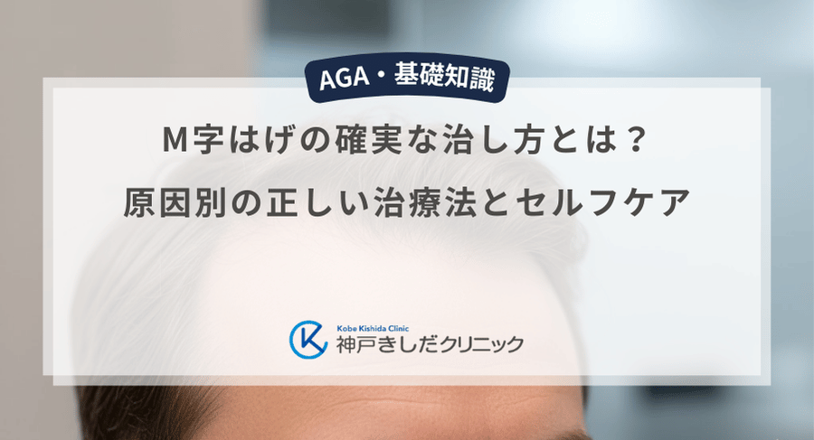 M字はげの確実な治し方とは?原因別の正しい治療法とセルフケア