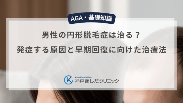 男性の円形脱毛症は治る？発症する原因と早期回復に向けた治療法