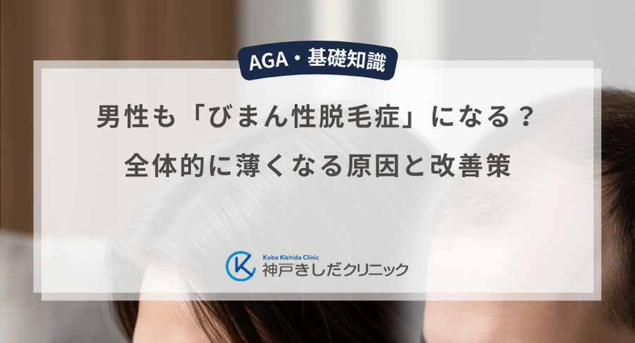 男性も「びまん性脱毛症」になる？全体的に薄くなる原因と改善策