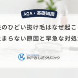 男性のひどい抜け毛はなぜ起こる？止まらない原因と早急な対処法