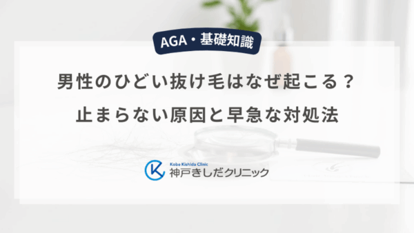 男性のひどい抜け毛はなぜ起こる？止まらない原因と早急な対処法