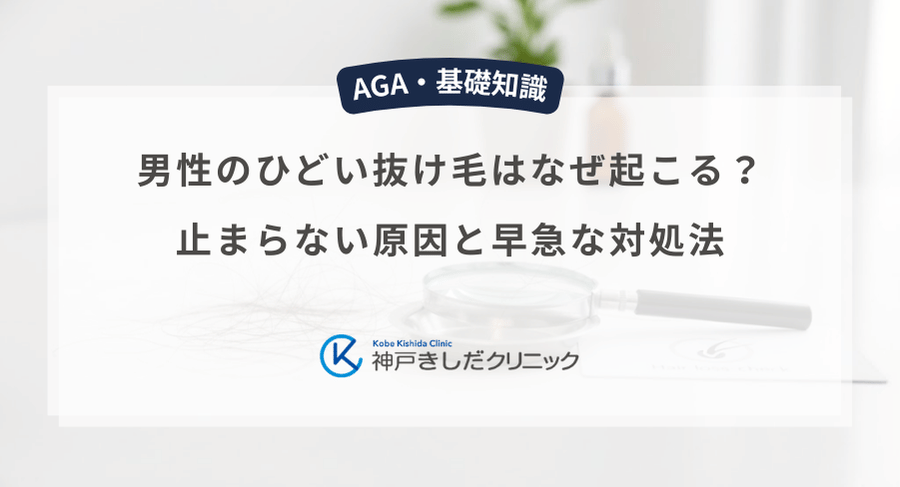 男性のひどい抜け毛はなぜ起こる？止まらない原因と早急な対処法