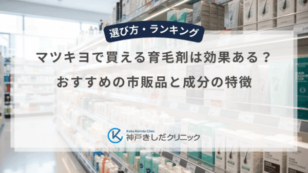 マツキヨで買える育毛剤は効果ある？おすすめの市販品と成分の特徴