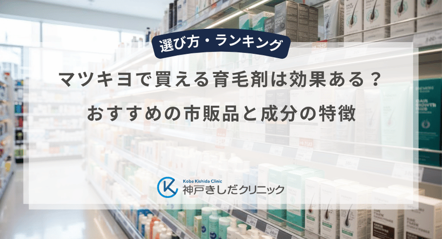 マツキヨで買える育毛剤は効果ある？おすすめの市販品と成分の特徴
