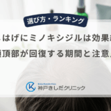 つむじはげにミノキシジルは効果絶大？頭頂部が回復する期間と注意点
