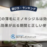 50代の薄毛にミノキシジルは効く？発毛効果が出る期間と正しい使い方