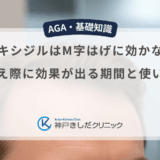 ミノキシジルはM字はげに効かない？生え際に効果が出る期間と使い方