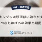 ミノキシジルは頭頂部に効きやすい？つむじはげへの効果と期間