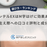 プランテルEXはM字はげに効果あり？生え際への口コミ評判と成分