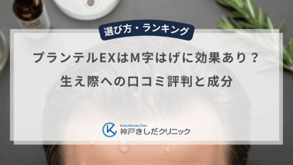 プランテルEXはM字はげに効果あり？生え際への口コミ評判と成分
