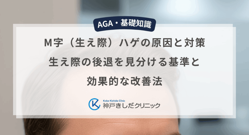 M字（生え際）ハゲの原因と対策｜生え際の後退を見分ける基準と効果的な改善法