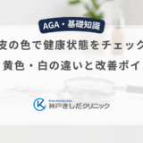 頭皮の色で健康状態をチェック！赤・黄色・白の違いと改善ポイント