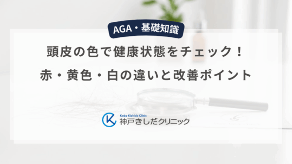 頭皮の色で健康状態をチェック！赤・黄色・白の違いと改善ポイント