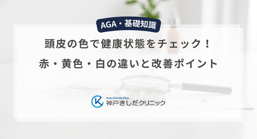 頭皮の色で健康状態をチェック！赤・黄色・白の違いと改善ポイント