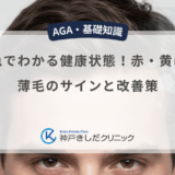 頭皮の色でわかる健康状態！赤・黄は危険？薄毛のサインと改善策