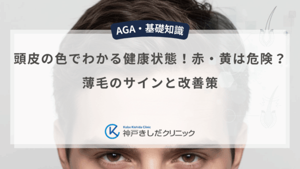 頭皮の色でわかる健康状態！赤・黄は危険？薄毛のサインと改善策