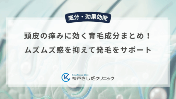 頭皮の痒みに効く育毛成分まとめ！ムズムズ感を抑えて発毛をサポート