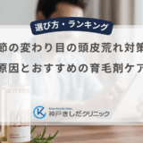 季節の変わり目の頭皮荒れ対策！原因とおすすめの育毛剤ケア