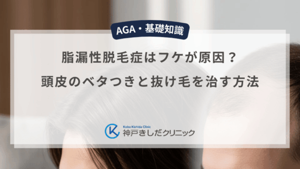 脂漏性脱毛症はフケが原因？頭皮のベタつきと抜け毛を治す方法