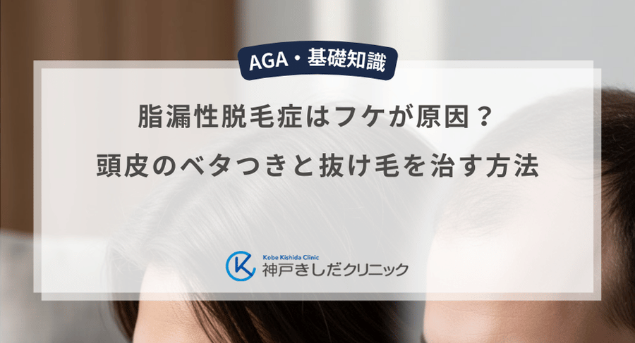 脂漏性脱毛症はフケが原因?頭皮のベタつきと抜け毛を治す方法