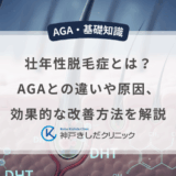 壮年性脱毛症とは？AGAとの違いや原因、効果的な改善方法を解説