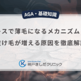 ストレスで薄毛になるメカニズムとは？抜け毛が増える原因を徹底解説