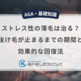 ストレス性の薄毛は治る？抜け毛が止まるまでの期間と効果的な回復法