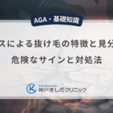 ストレスによる抜け毛の特徴と見分け方！危険なサインと対処法