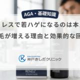 ストレスで若ハゲになるのは本当？抜け毛が増える理由と効果的な回復法