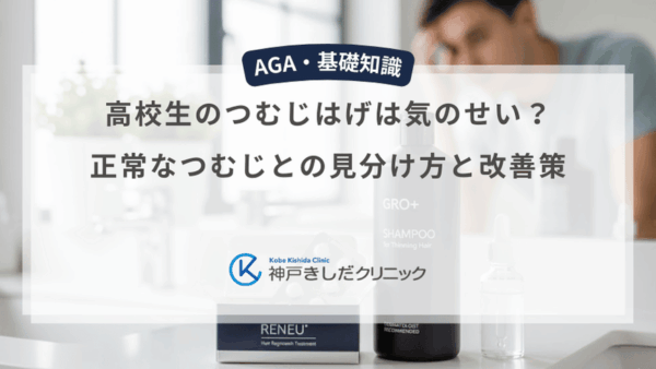 高校生のつむじはげは気のせい？正常なつむじとの見分け方と改善策